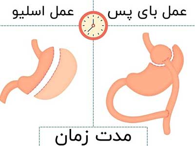 مدت زمان جراحی در بای پس و اسلیو معده