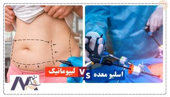 تفاوت‌ بین جراحی اسلیو معده و لیپوماتیک