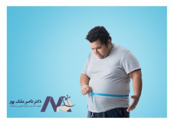 Benefits-of-varicose-veins-stockings-after-bariatric-surgery فواید جوراب واریس بعد از جراحی چاقی