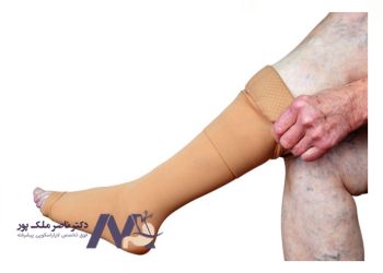 How-to-wear-varicose-veins-stockings نحوه پوشیدن جوراب واریس