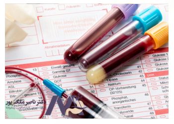 Treatment-of-anorexia-nervosa درمان بی اشتهایی عصبی