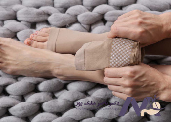 The-best-home-treatment-for-varicose-veins بهترین درمان واریس پا در خانه