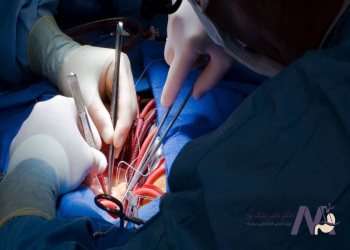 Open-vascular-surgery جراحی عروق باز
