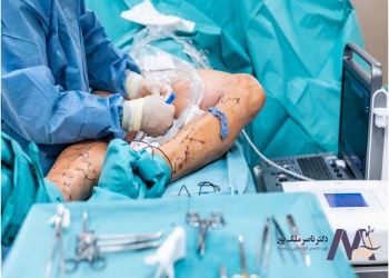 The-best-peripheral-vascular-surgeon بهترین جراح عروق محیطی