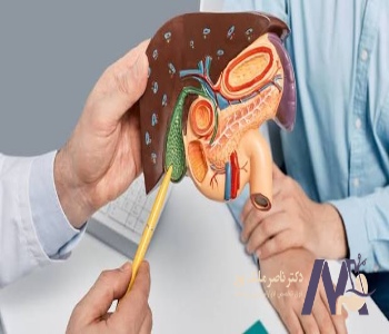 Characteristics of the best gallbladder specialist in Tehran ویژگی های بهترین متخصص کیسه صفرا در تهران