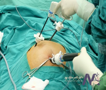 Dr. Nasser Malekpour, the best gallbladder specialist in Tehran دکتر ناصر ملک پور، بهترین متخصص کیسه صفرا در تهران