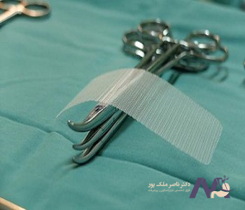 Characteristics-of -mesh -types in -hernia-surger-min ویژگی های انواع مش در جراحی فتق