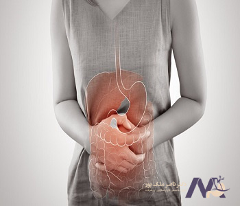Complications of-obesity after-gallbladder surgery_min عوارض چاقی بعد از عمل کیسه صفرا