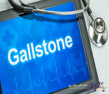 Gallstone-diagnosis تشخیص سنگ کیسه صفرا