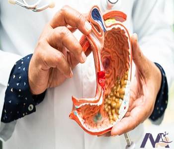 Obesity-after-gallbladder surgery-due to-hormonal changes_min چاقی بعد از عمل کیسه صفرا به دلیل تغییرات هورمونی