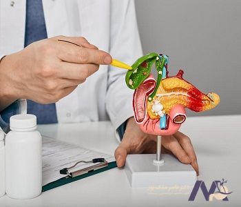 Preventing-gallbladder-filling-min پیشگیری از پر شدن کیسه صفرا