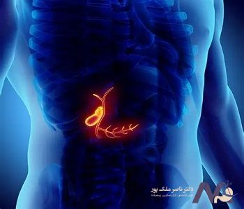 Symptoms-and-treatment-of-gallbladder-fullness_min علائم و درمان پر شدن صفرا