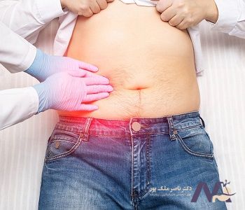 Symptoms-of a full-gallbladder_min علائم پر شدن کیسه صفرا