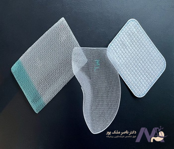 Types-of-mesh-in-hernia-surgery_min انواع مش در جراحی فتق