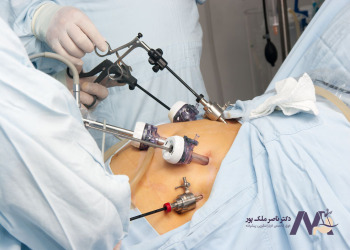 Benefits-Laparoscopic-Treatment-Gastroesophageal-Reflux مزایای درمان رفلاکس معده با لاپاراسکوپی