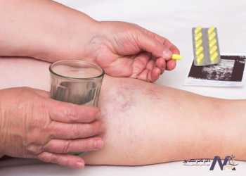 Guide-to-choosing-best-varicose-vein-surgeon-in-Tehran راهنمای انتخاب بهترین جراح واریس در تهران