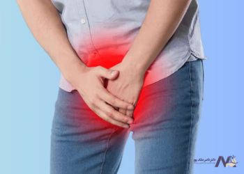 درمان واریس بیضه در مردان