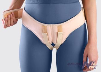 مزایا فتق بند