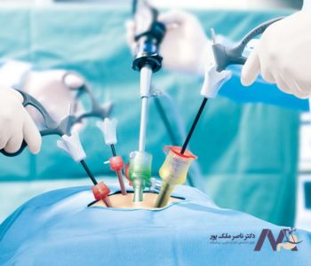 هزینه عمل لاپاراسکوپی با دفترچه بیمه