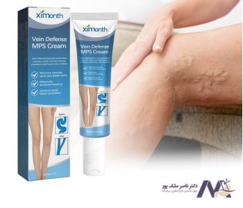 How-to-choose-right-ointment-for-treating-varicose-veins نحوه انتخاب پماد مناسب برای درمان واریس