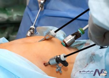 قیمت جراحی لاپاراسکوپی 1404