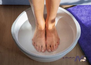 روش‌های درمان واریس با آب سرد