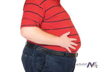 اهمیت وزن در جراحی اسلیو معده