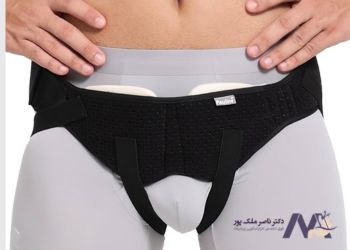 انواع فتق بند