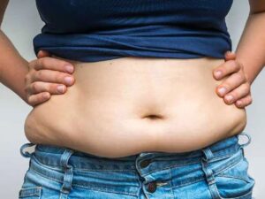 علت چاقی شکم در مردان و زنان