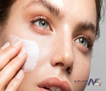 پیشگیری از واریس صورت