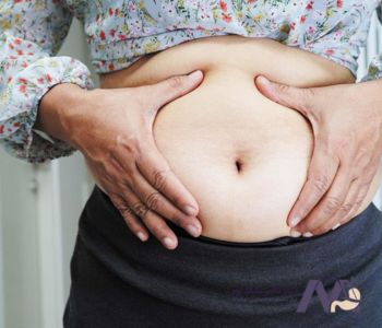 The-most-common-causes-of-abdominal-obesity-in-men-and-women شایع ترین دلایل چاقی شکم در مردان و زنان
